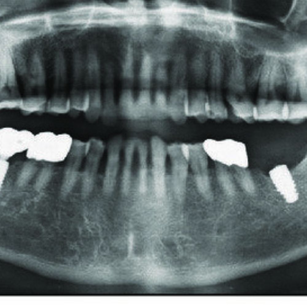 fraude de idental denuncias idental fraude idental idental denuncias idental estafa idental fraude idental juicio idental quejas juicio idental quejas idental reclamaciones idental reclamar a idental reclamar idental como denunciar a idental como reclamar a idental denunciar a idental estafa de idental estafa idental idental reclamaciones reclamaciones a idental